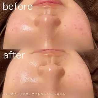 lulularico Yuのエステ・リラクイメージ