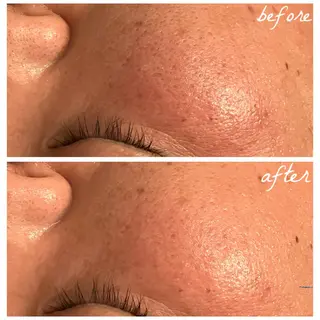 メンズ メナード岐阜市茜部 杉浦のエステ・リラクイメージ