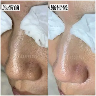 マツヤニWax専門/ 岸和田/Luanaのエステ・リラクイメージ