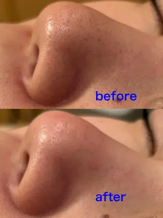 Fulala 永田のエステ・リラクイメージ