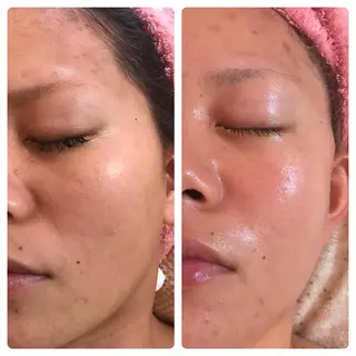 フェアリーローズ所属・fairyrose organicエステのエステ・リラクイメージ