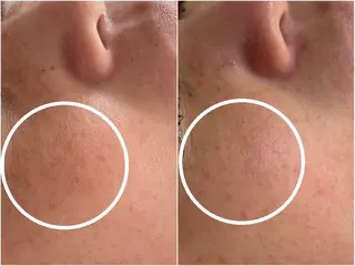 肌質改善|天王寺 For...はるかのエステ・リラクイメージ