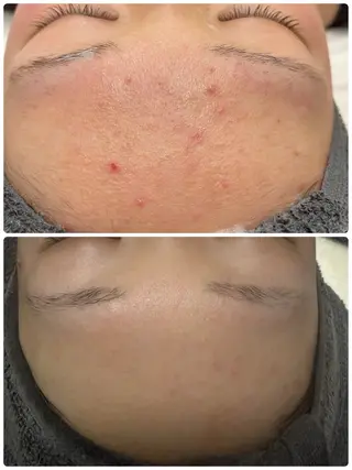 NHerb【エヌハーブ】所属・横田 汐里のネイルデザイン