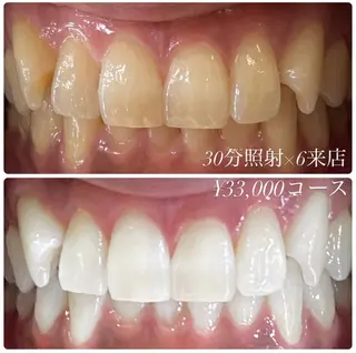 メンズ キッズ ホワイトニングルーム　川崎店所属・ホワイトニング ルーム　川崎店のその他イメージ