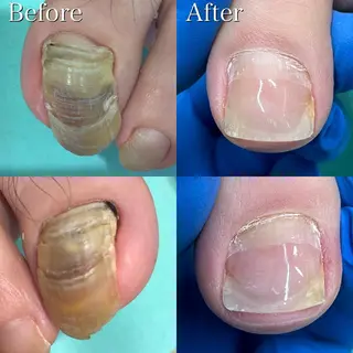 ネイル サンキューフット浦和店所属・サンキューフット 浦和店のエステ・リラクイメージ