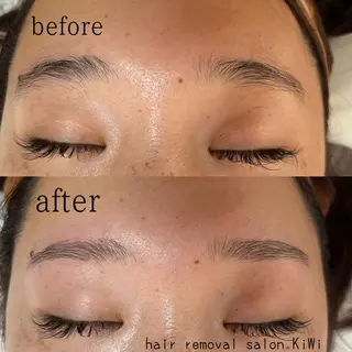 アイブロウ 脱毛サロン KiWiのエステ・リラクイメージ