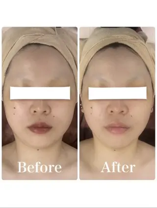 メンズ 小顔フェイシャル 専門店Soarのエステ・リラクイメージ