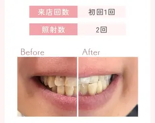 セルフホワイトニングエクシア小山店所属・セルフホワイトニング エクシア小山店のその他イメージ