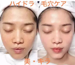 美・キラ ハイフ痩身&美肌のエステ・リラクイメージ