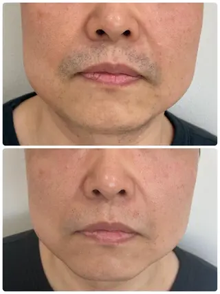 メンズ hyakutake itsumiのネイルデザイン