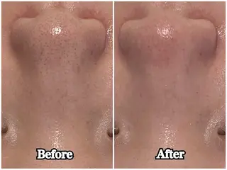 韓国肌管理専門店　White labo 梅田店所属・大西 亜季のエステ・リラクイメージ