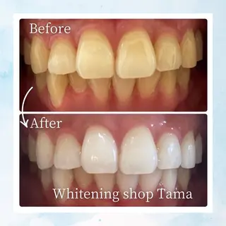 ホワイトニング ショップ多摩店のその他イメージ
