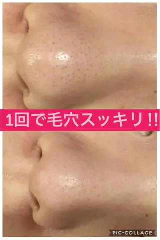 ショート カラー パーマ ヘアアレンジ メンズ キッズ ネイル マツエク・マツパ ニキビ・肌質改善専門 ♡人生が変わるサロンのエステ・リラクイメージ