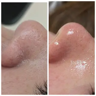 結果が出るスキンケア 肌質改善/まつパのエステ・リラクイメージ