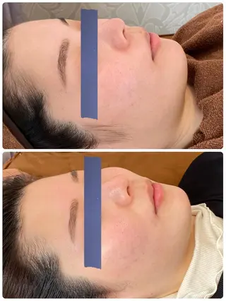 FLEURフェイシャ ル🫧ハーブ🌿小顔のエステ・リラクイメージ