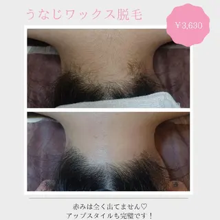 Lutella所属・ワックス脱毛専門店 Lutellaのエステ・リラクイメージ