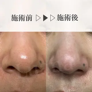 eyelash salon Luana所属・Luana 【ルアナ】小山のエステ・リラクイメージ