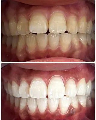 LIBRAセルフホワイトニングサロン高槻本店所属・龍野 みどりのその他イメージ