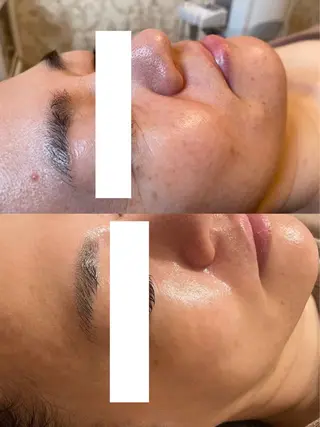 西区九条エステ MITUREIサロンのエステ・リラクイメージ