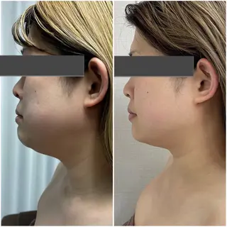 MIRAI小顔 岡山店のエステ・リラクイメージ