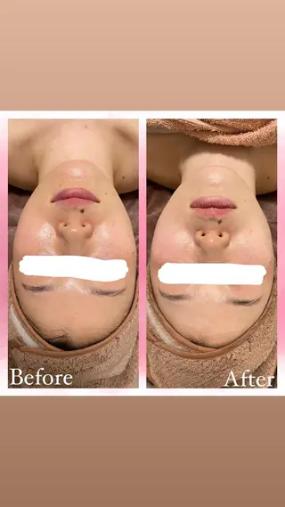 salon〜RePCa〜(サロンルピカ)所属・山﨑 藍のエステ・リラクイメージ