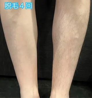 スリーエスプラス内　美肌サロンEme所属・希映 -kieのエステ・リラクイメージ