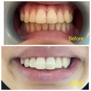 M渋谷店所属・Ｍ渋谷 ホワイトニングのエステ・リラクイメージ