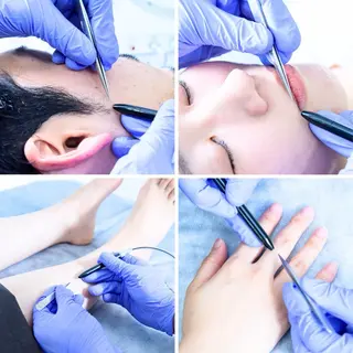 【一本ずつ脱毛】 ReMove 柏のエステ・リラクイメージ