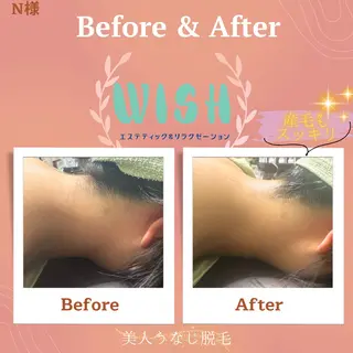 WISH 美肌脱毛のプロ！須藤のエステ・リラクイメージ