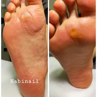 ネイル 西日暮里 Nabinailのネイルデザイン