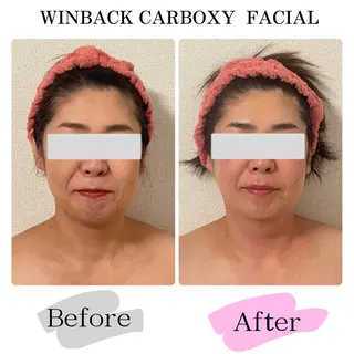 痩身小顔IRISER Akiのエステ・リラクイメージ