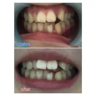 MBEAUTYSALON 千葉店・京成大久保所属・Melty 輝のその他イメージ