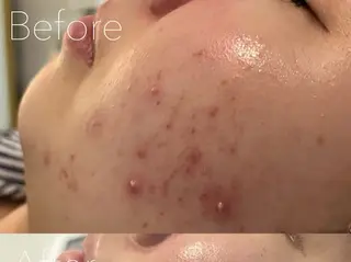 韓国肌管理Belle 神戸元町のエステ・リラクイメージ