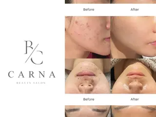 CARNA所属・【肌質改善専門店】 CARNAのエステ・リラクイメージ