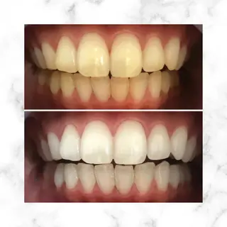 LBSホワイトニング 🌐渋谷店スタッフのエステ・リラクイメージ