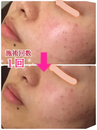 ロング カラー パーマ ヘアアレンジ メンズ キッズ ネイル マツエク・マツパ ‍痩身＆ボディ 結果出し🌟丹野のエステ・リラクイメージ