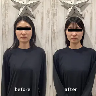 小顔矯正/整体師 丸山綾野のその他イメージ