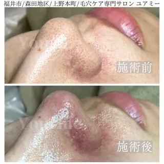 毛穴肌質ケアサロン Yourmeユアミーのエステ・リラクイメージ