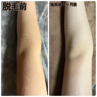 キッズ Puki Puki 脱毛サロンのエステ・リラクイメージ