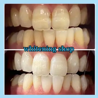 ホワイトニング ショップ千葉店のその他イメージ