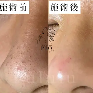 毛穴専門サロン　フルール所属・フルールFululu 自由が丘のエステ・リラクイメージ