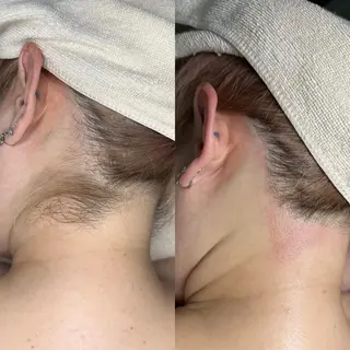 ヘアアレンジ WAX&光脱毛 ESTHERIAのエステ・リラクイメージ