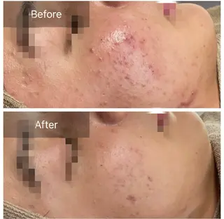 ハーブピーリング 専門／今榮麻美のエステ・リラクイメージ