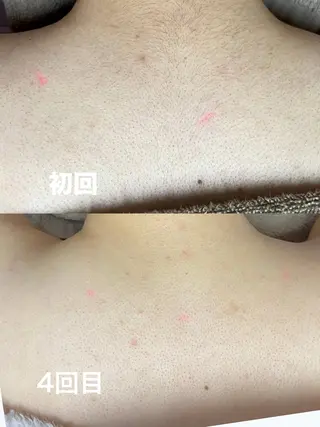 【美肌専門 脱毛】 サロンドジェシカのエステ・リラクイメージ