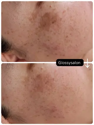Glossy salonのエステ・リラクイメージ