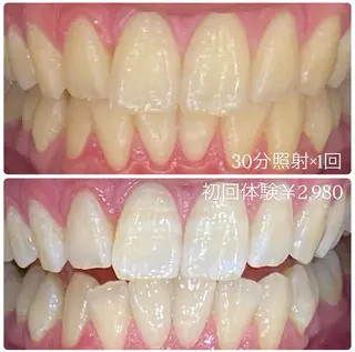 PLATINUM Beauty 横浜店所属・ホワイトニングルーム 横浜店のその他イメージ