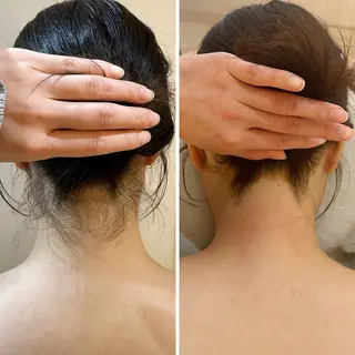 うなじ脱毛/美肌脱毛 LABELのエステ・リラクイメージ