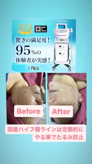 Chalon所属・REVI取扱・肌悩み 毛穴Chalonのエステ・リラクイメージ