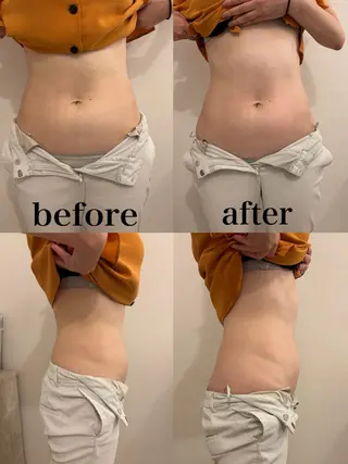 腸活サポート みなみののエステ・リラクイメージ