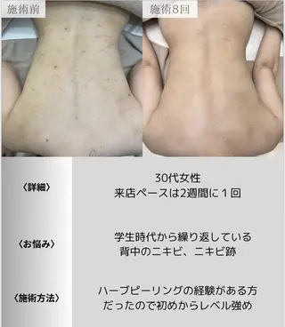 脱毛・眉毛・フェイス サロンN久留米店の眉毛・アイブロウイメージ